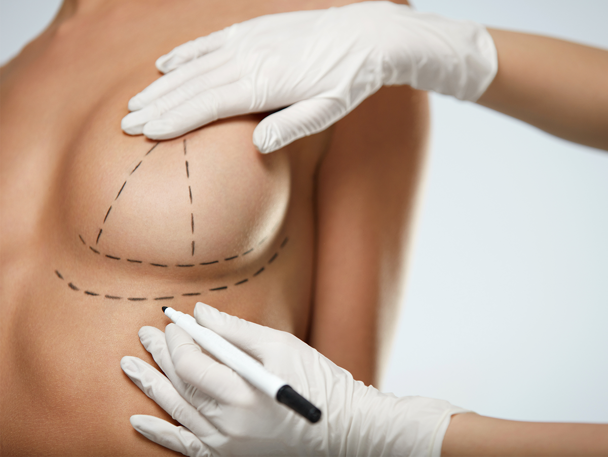 Breast Lift