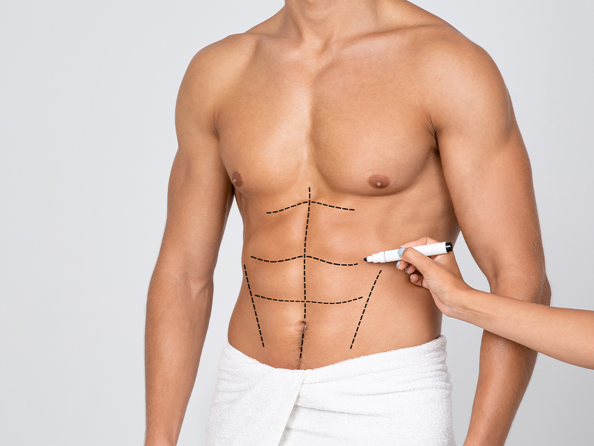 Six Pack Surgery